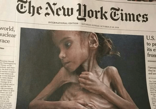 وفاة الطفلة أمل التي لفتت أنظار العالم للمجاعة في اليمن