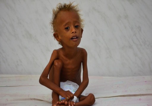 مسؤول أممي: طفل يمني دون الخامسة يموت كل 12 دقيقة