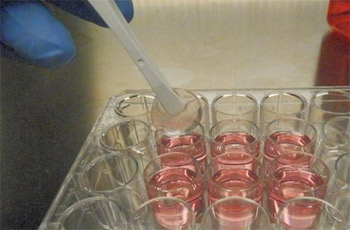 طريقة جديدة لعلاج سرطان الدم