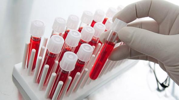 الصحة العالمية تحث على استخلاص أدوية من الدم ضد أيبولا