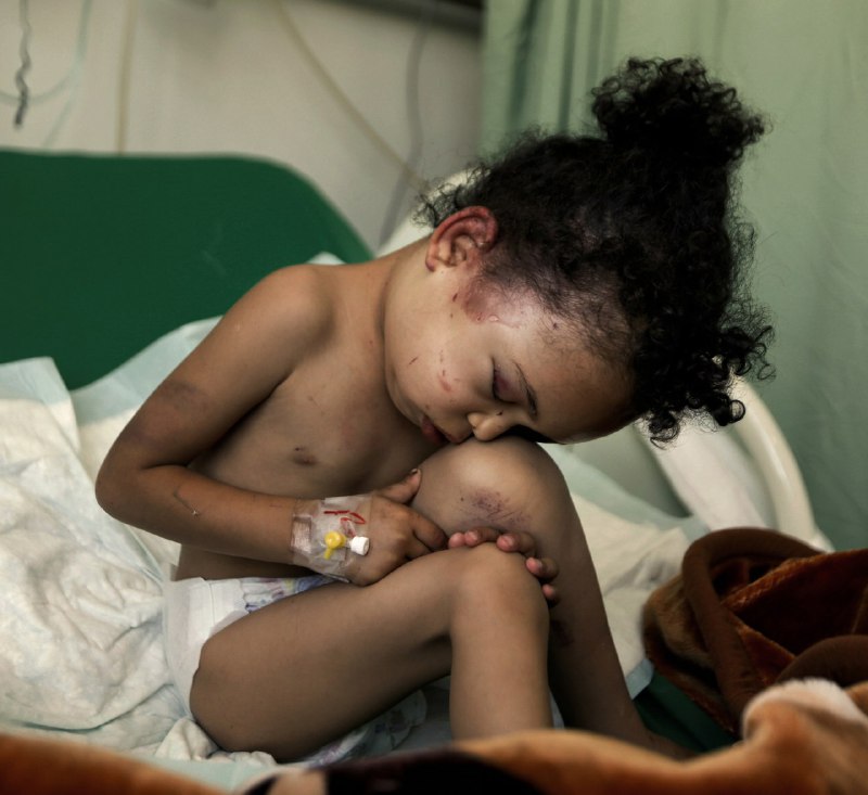 «نيويورك تايمز»: صور من اليمن لا يريدك التحالف وأمريكا أن تراها