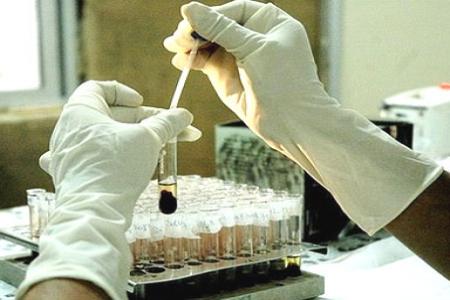 تراجع في عدد وفيات "الإيدز" خلال 2013